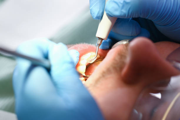 Best Emergency Gum Pain Relief  in Lake Belvedere Estates, FL