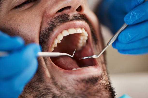 Best Dentist for Tooth Abscess  in Lake Belvedere Estates, FL